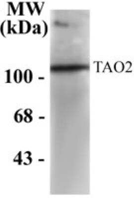 Western Blot: TAO2 [p Ser181] Antibody [NB300-233]